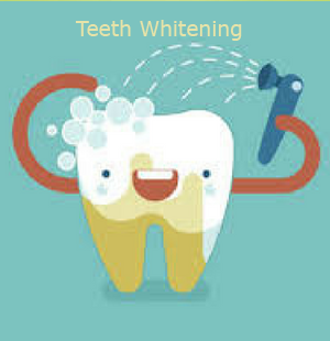 teeth whitening